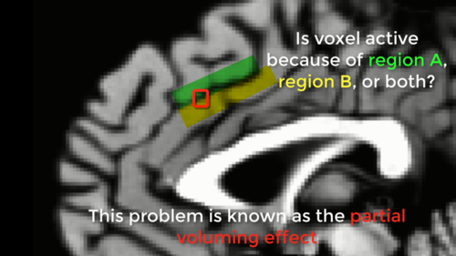../_images/01_PartialVoluming.png