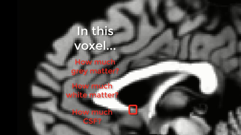 ../_images/01_PartialVoluming_TissueTypes.png