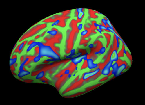 ../_images/01_StatisticalMap_Surface.png