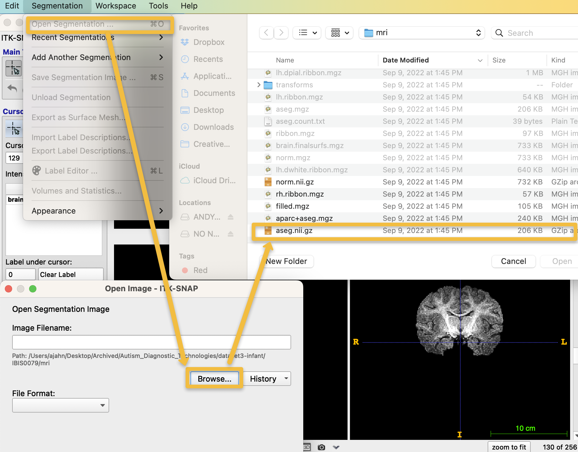 ../_images/02_AddSegmentation.png