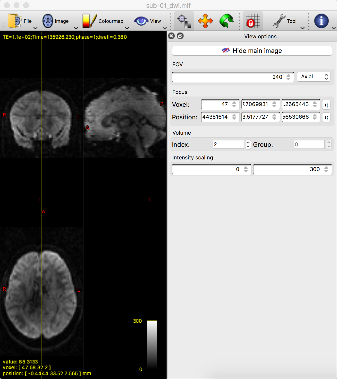 ../_images/03_mrview_IntensityScaling.png