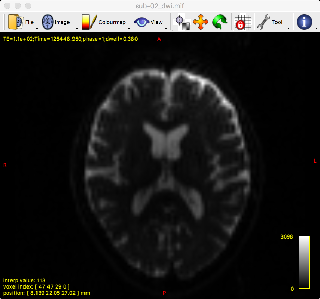 ../_images/03_mrview_axial.png