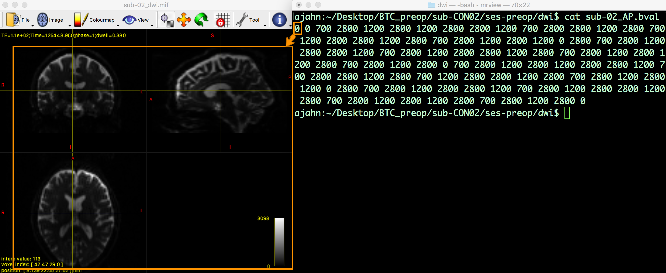 ../_images/03_mrview_firstVolume_bval.png