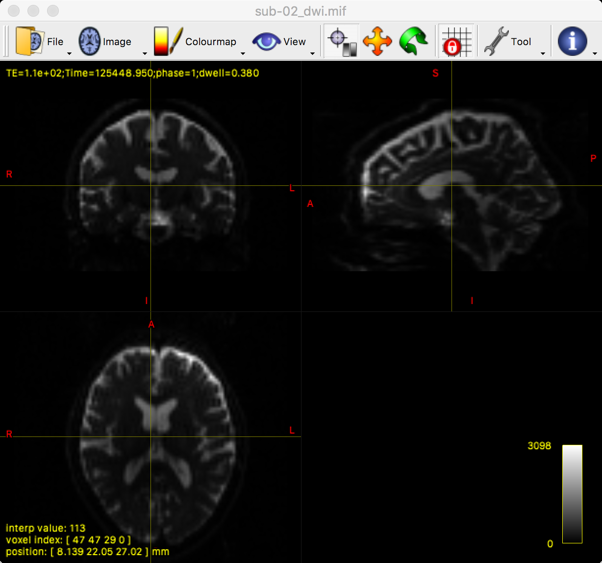 ../_images/03_mrview_ortho.png