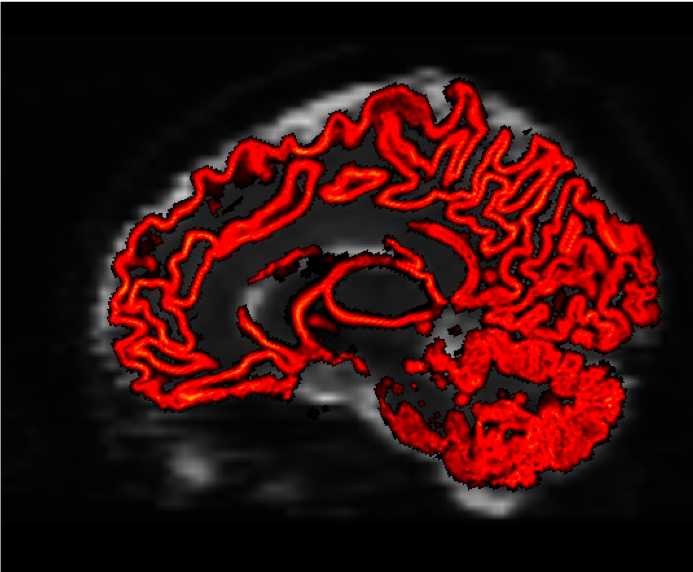 ../_images/06_GMWMI.png