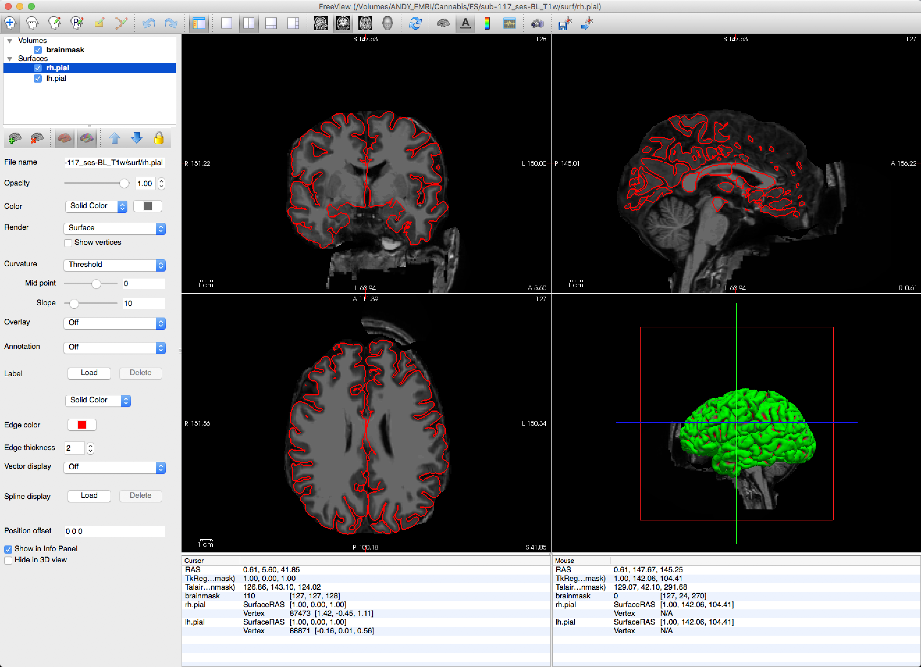 ../_images/13_sub117_Skull.png