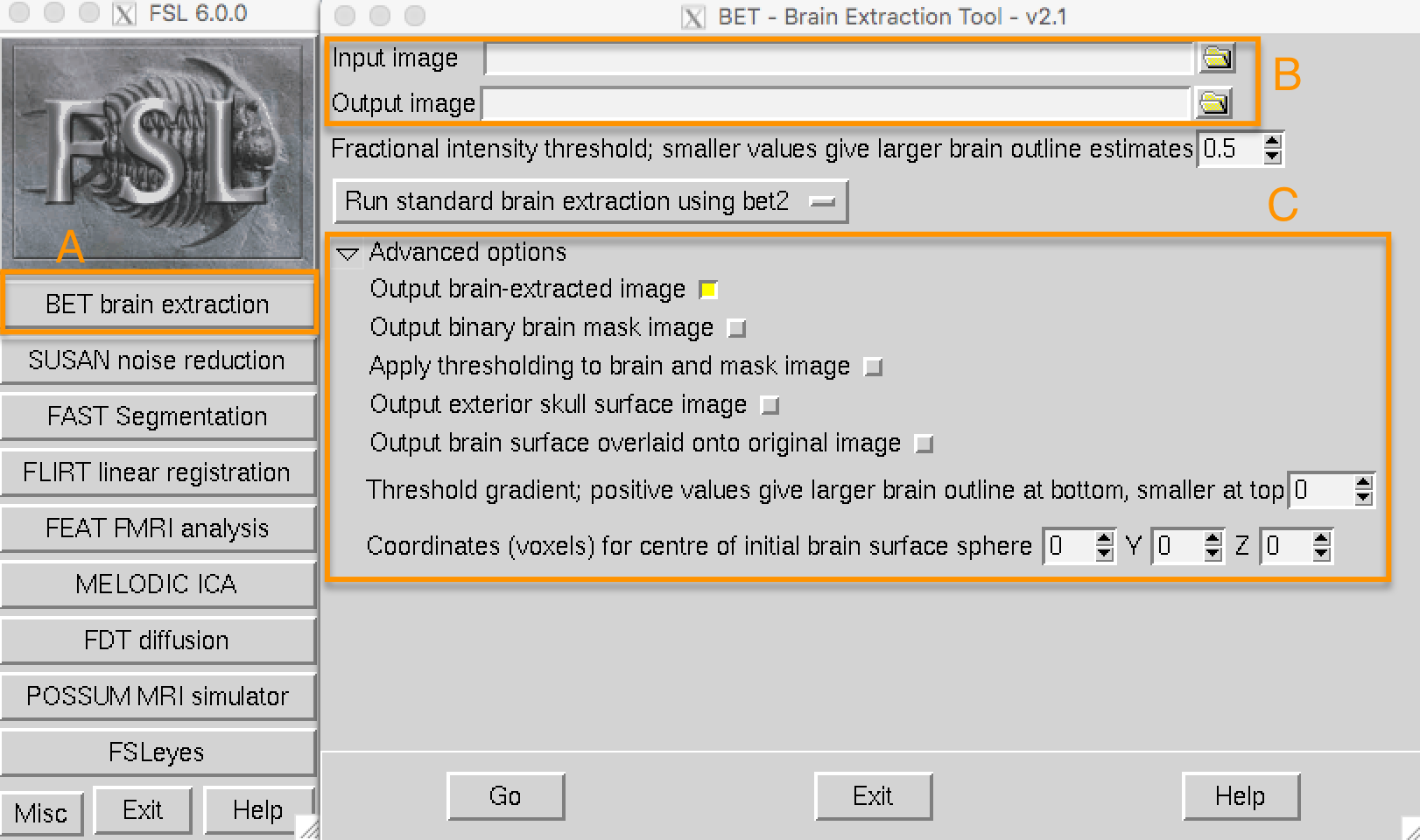 _images/FSL_BET_GUI.webp