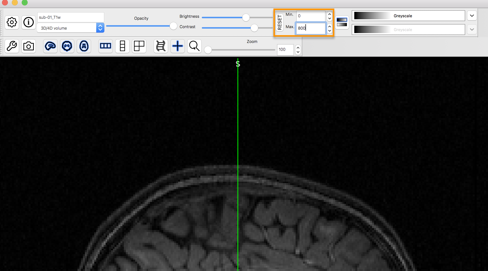 ../_images/anat_changeContrast.png